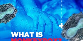What is MonkeyPox?