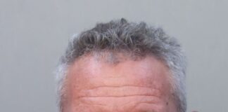 Man Arrested for Leaving Scene of Miami Springs Crash with Bodily Injury Elkis Rivero